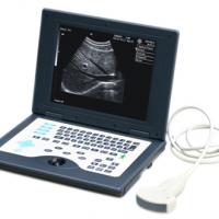Large picture Digital Laptop Ultrasound Scanner