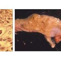 Large picture Coccidiosis in Chicken